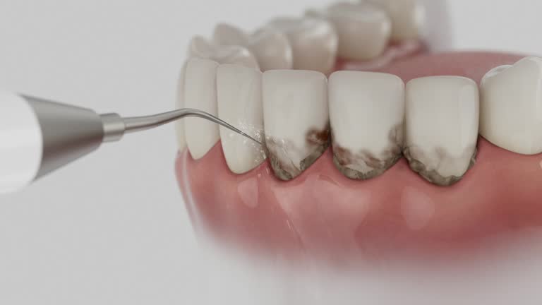 Trusted Teeth Whitening service in San Joaquin, CA - Dentist Open Now